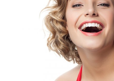 Faccette dentali estetiche 